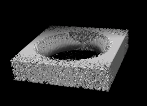 Tomogram of a 150 nm nanopore